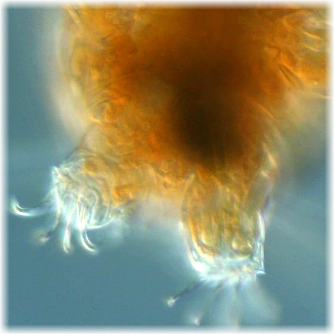 Tardigrade